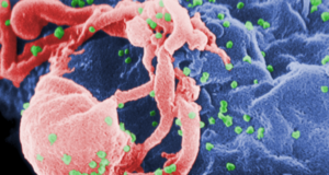 Virus hiv