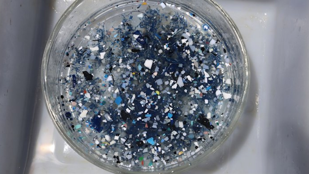 presenza di microplastiche nel cervello umano