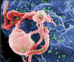 Virus dell'HIV in gemmazione da una cellula