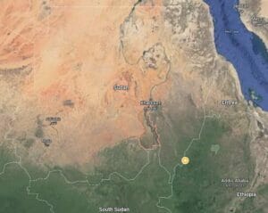 morbillo e malnutrizione in Sudan hji9