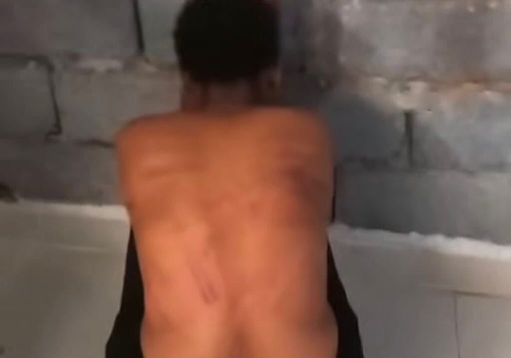 torture nei campi profughi in Libia